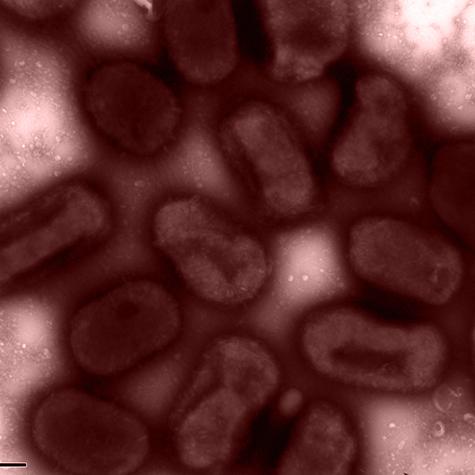 Bacteria Naturally Relinquish Defense against Antibiotics