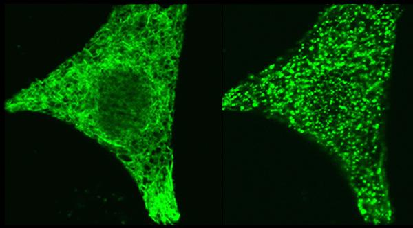 Active and Inactive STIM1