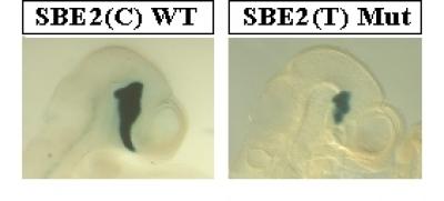 Sonic Hedgehog Control of Brain Development