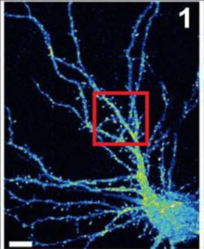 Hippocampal Neuron and Dendrites