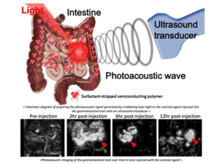 Using photoacoustic imaging to look deep into EurekAlert!