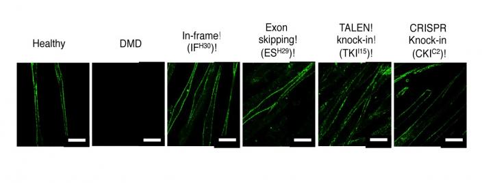 DMD-iPSCs Derived Skeletal Cells