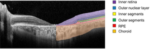 Retina layers segmented by deep learning