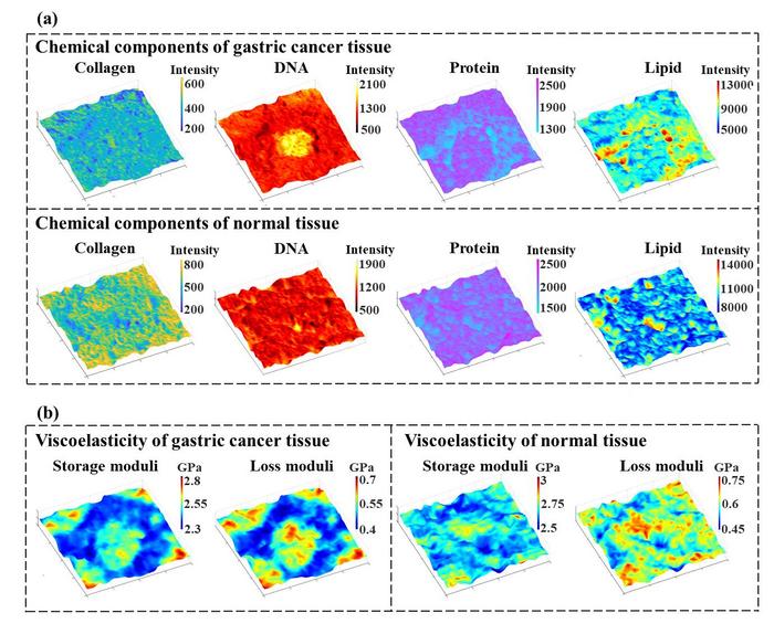 Fig. 3 Gastric cancer tissue and normal tissue mapping results.