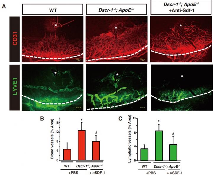 Efficacy of Anti-SDF-1 Neutralizing Antibody in a Corneal Inflammation Model
