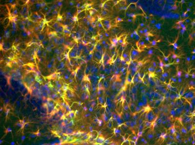 Astrocytes and A2A Receptors in a Mouse Model of Alzheimer's Disease