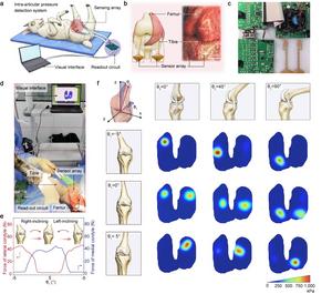 In vivo intra-articular pressure detection in a sheep model using flexible iontronic pressure sensor arrays.