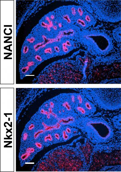 Expression Pattern in the Developing Lung