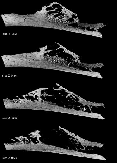 MicroCT Scan of Neandertal Rib
