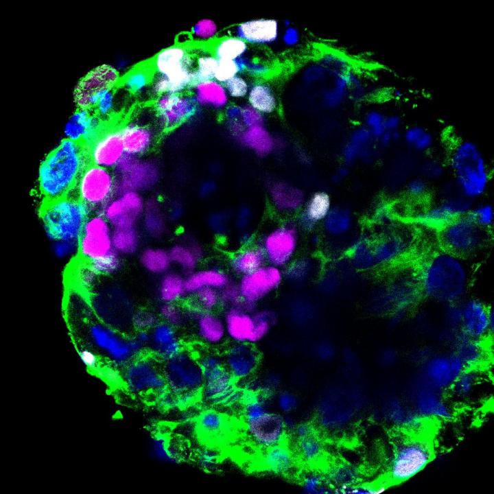 Image of a Human Embryo Cultured in Vitro