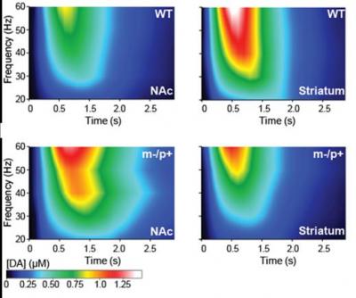 Study Justifies L-DOPA Therapy for Angelman Syndrome