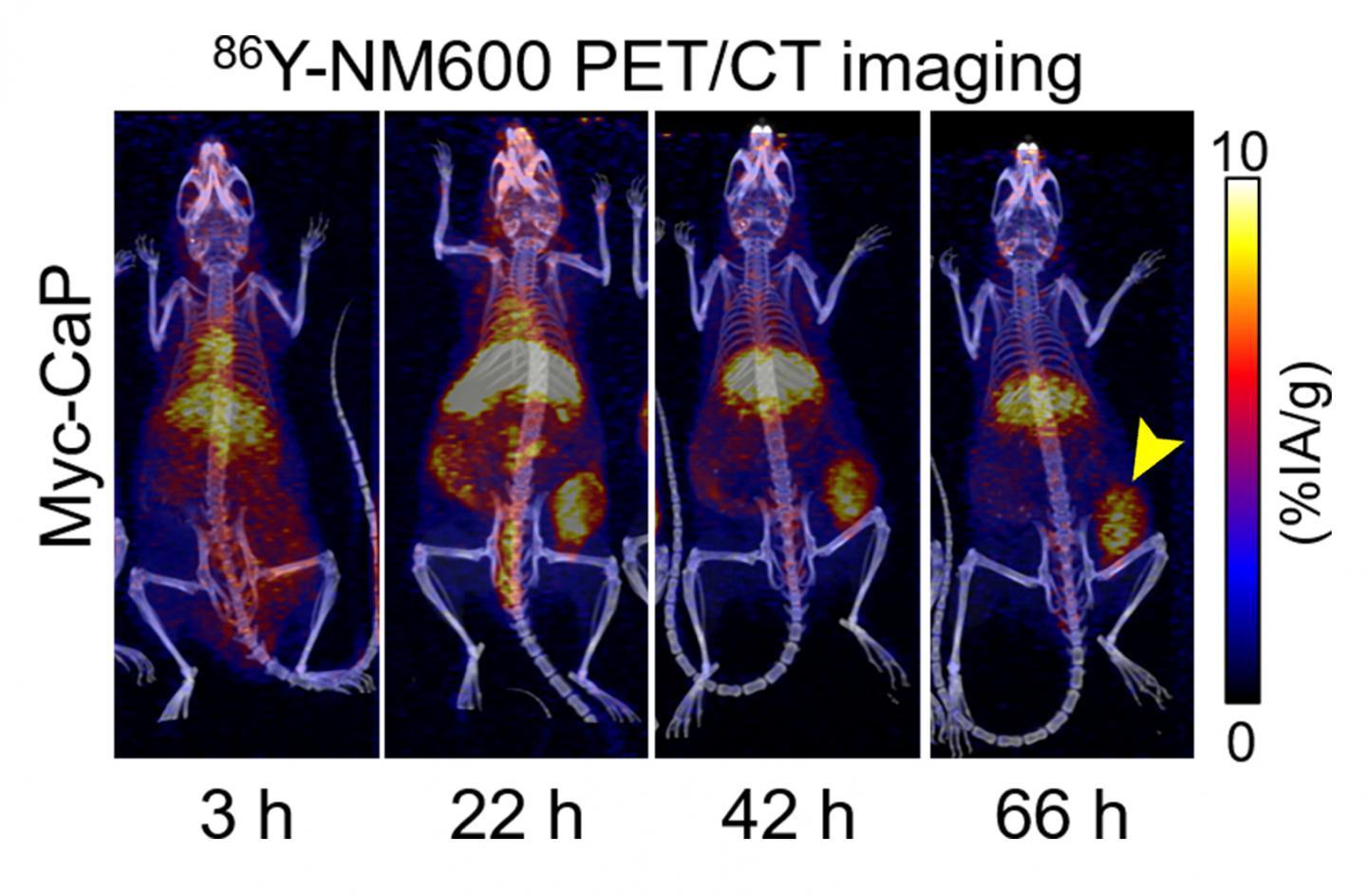 PET/CT Imaging 