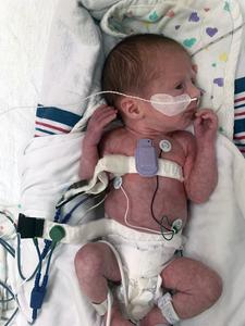 Devices on premature baby