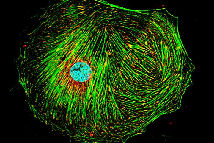 Stellate Cell Focal Adhesions and Cytoskeleton