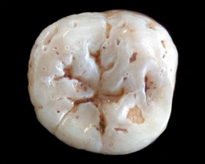 Neanderthal Tooth