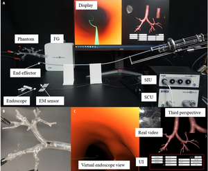 The proposed robotic bronchoscope system for navigation-assisted intervention