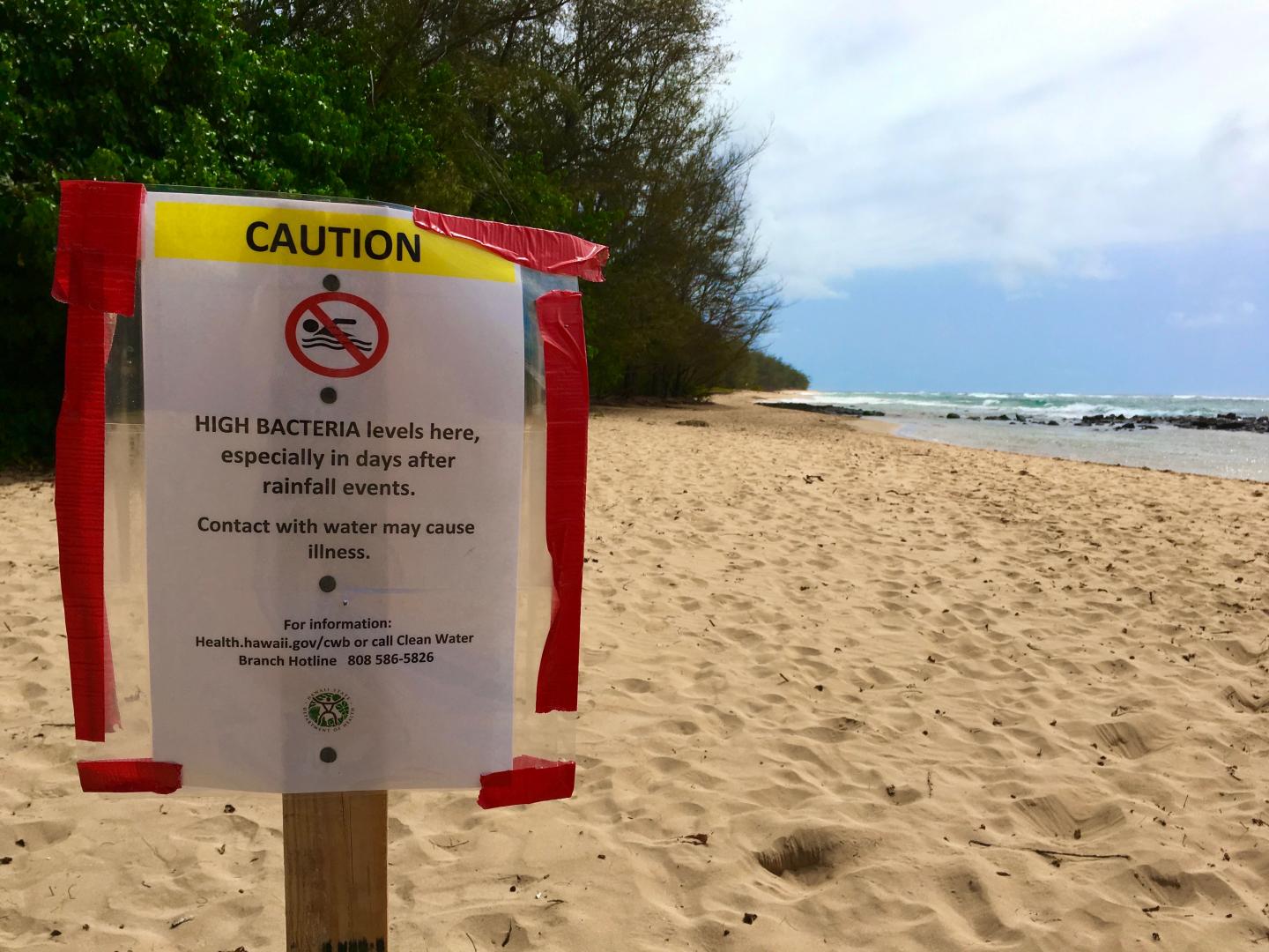 Beach Hazard Sign