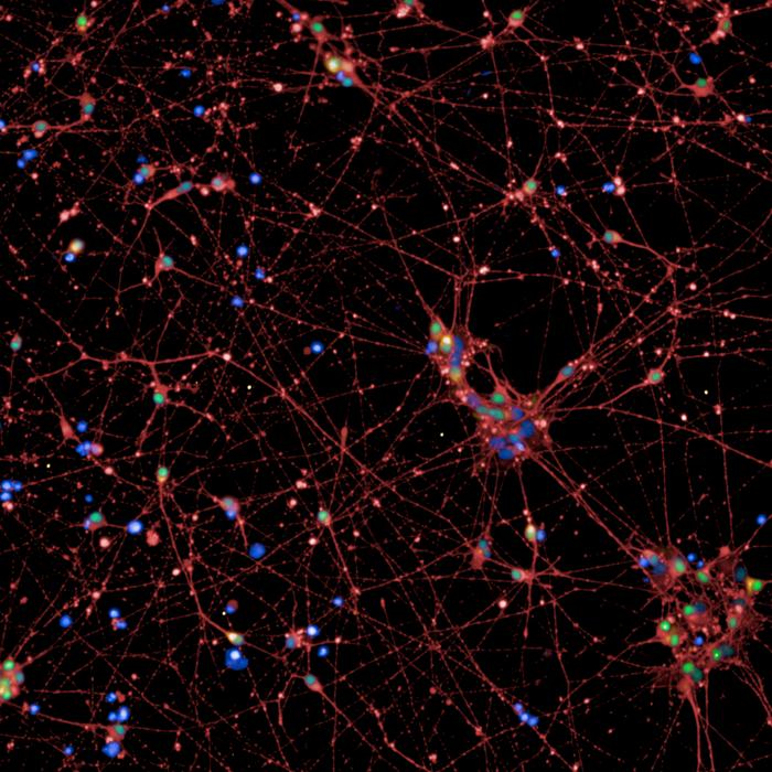 Neurons with active POMC gene © Charité | Lara Lechner