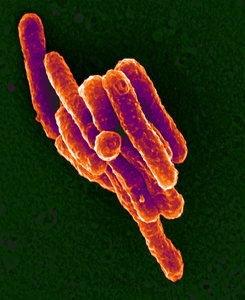 Mycobacterium tuberculosis, the bacteria that causes human tuberculosis