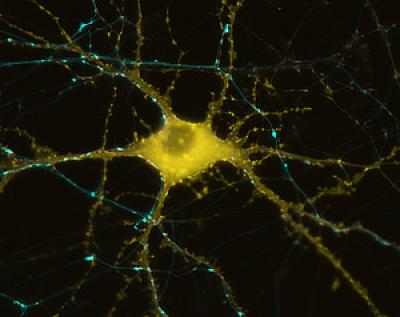Human Neuron