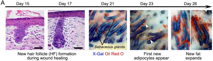 Progression of Wound