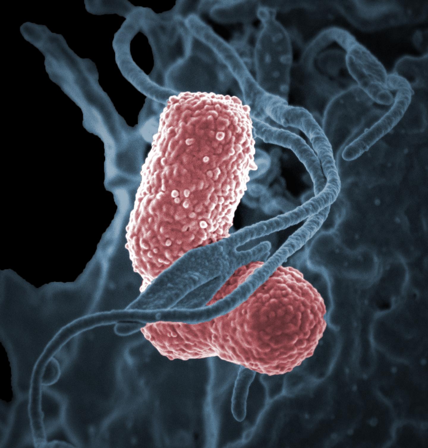 A human neutrophil interacting with Klebsiella pneumoniae