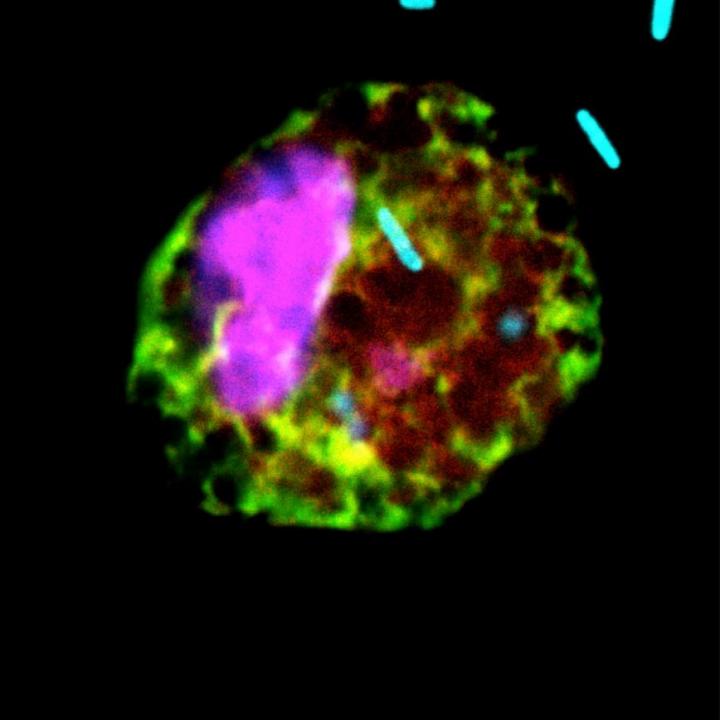 Pseudomonas Bacteria Better Harness Their Fuel Source, Driving Lung Infections in Cystic Fibrosis (2 of 2)