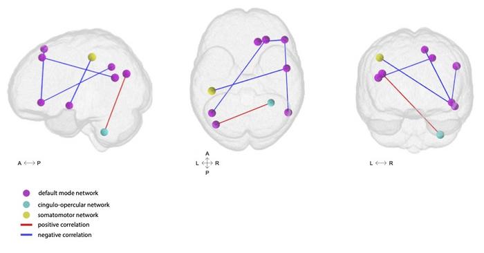 Brain connectivity over time