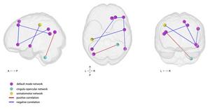 Brain connectivity over time