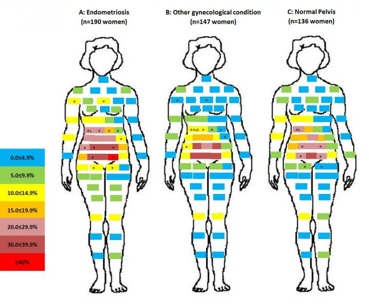 Pelvic Pain Map