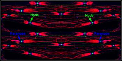 Mouse Sciatic Nerve Myelinated Axons