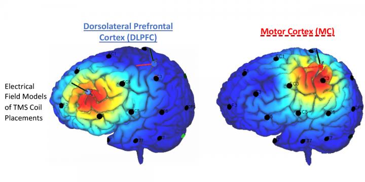 DLPFC vs. MC