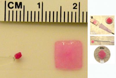 Compression and Expansion of Injectable Gel Scaffold