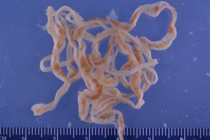 tapeworm in humans stomach