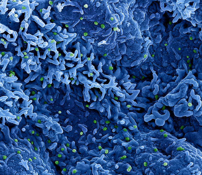 Monkeypox virus (green) on the surface of infected VERO E6 cells (blue)