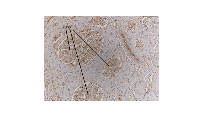 Dolphin clitoris nerves