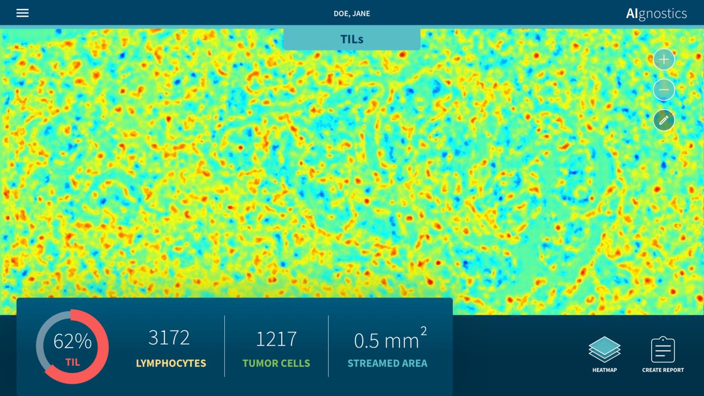 Heatmap of a Breast Cancer Tissue Sample