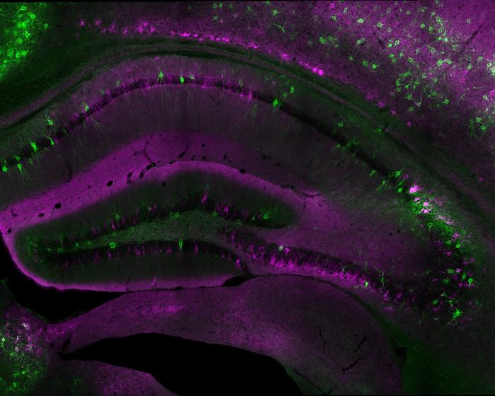 Labeled mouse hippocampus