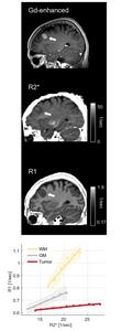 MRI image with contrast agent (Gd-enhanced), and quantitative MRI images