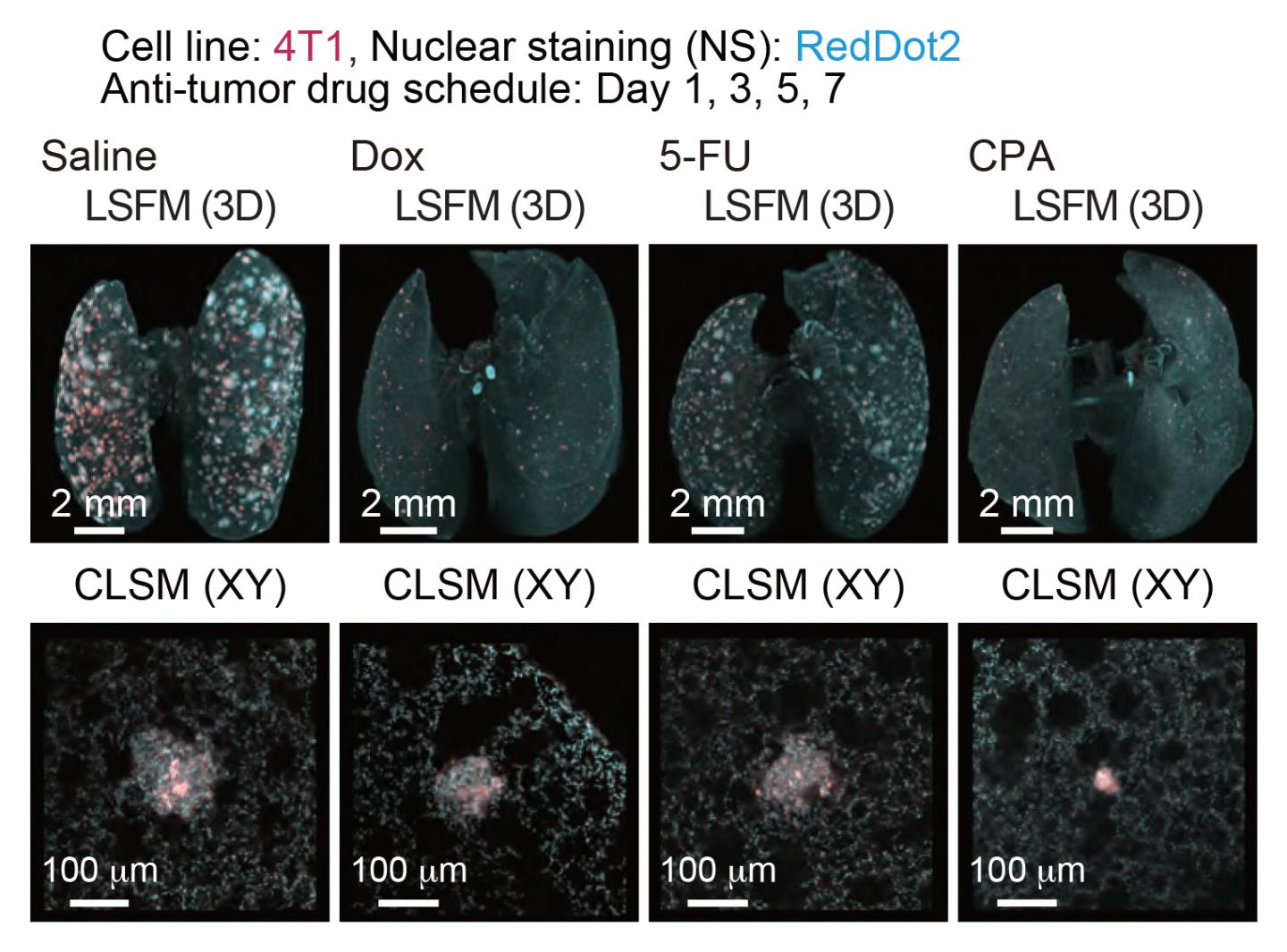 Quantitative Evaluation of Therapeutic Effects of Anti-Tumor Drugs in an Experimental Lung Metastati