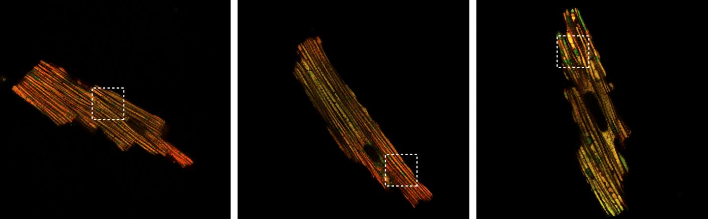 <em>Mfn2</em>-deficient Mitochondria