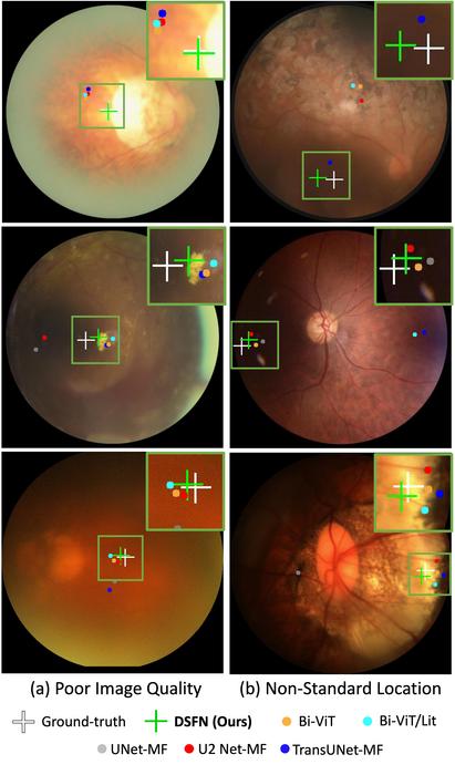 Fovea localisation using AI imaging