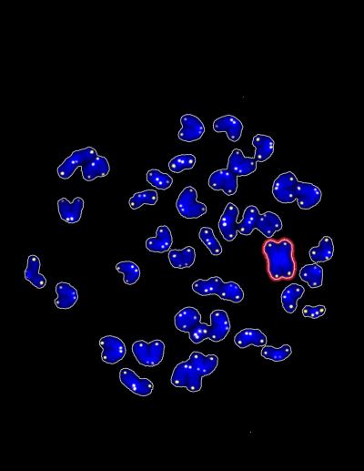 Chromosome Abnormalities in Reprogrammed Cells in Which SIRT1 Protein Has Been Removed (In Red) -- C