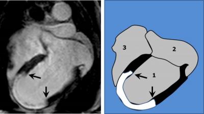 Consecuences of the Trial