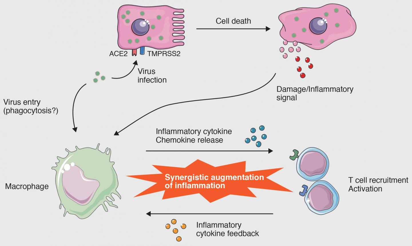 Macrophage Activation Syndrome in COVID-19