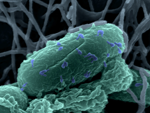 Electron microscopy image of bacteriophages (blue) attached to the surface of an enteroaggregative Escherichia coli strain 55989 cell (green).