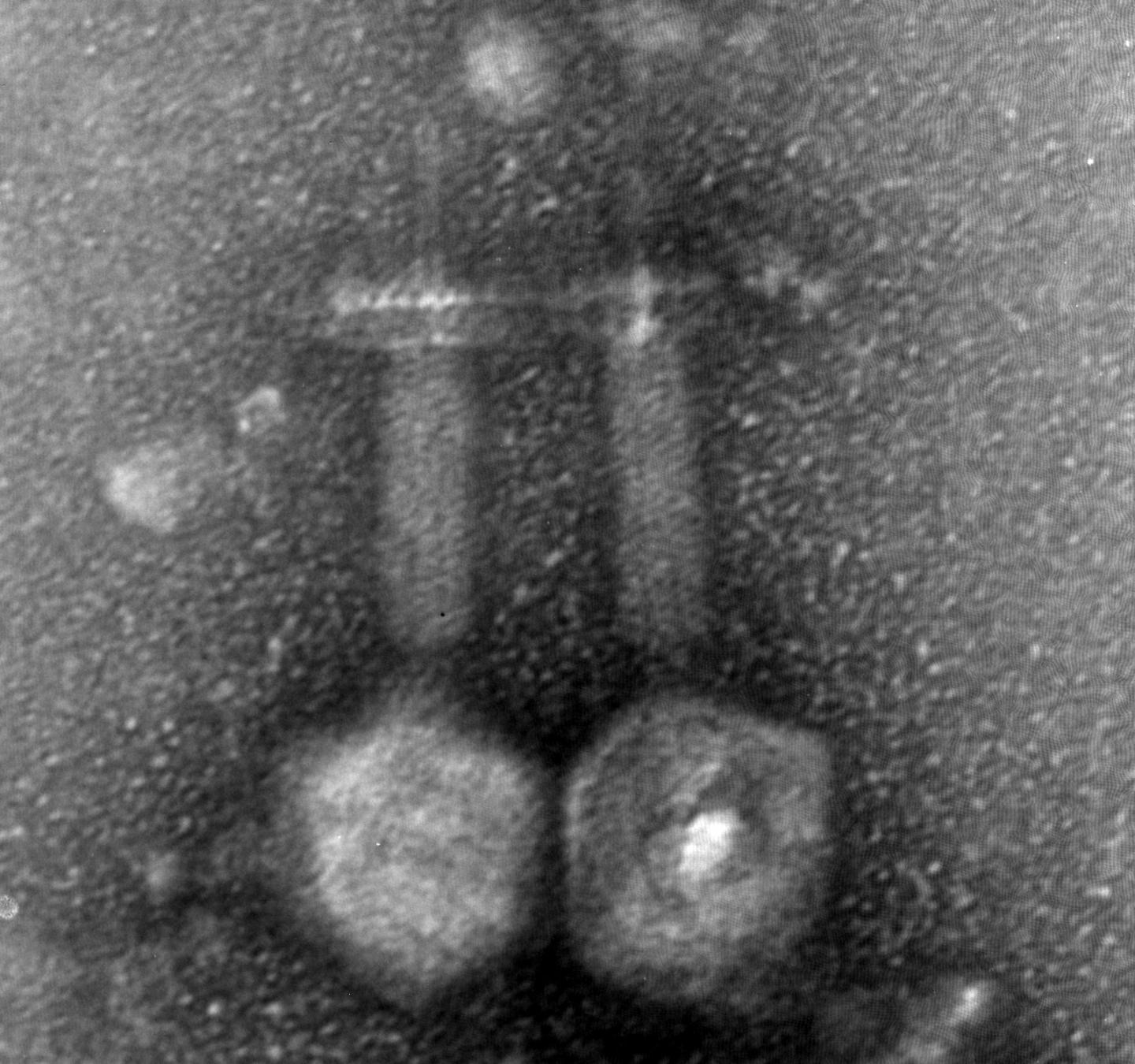 Bacteriophage EFDG1 Magnified 20,000 -- 30,000 Times
