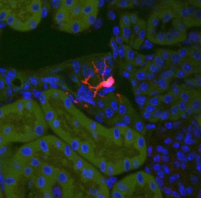 Identifying the Cellular Origin of Fibrosis