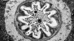 Fruit Fly Gut Microbiome Colonization