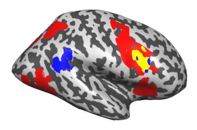 Coordinating Attention in the Brain